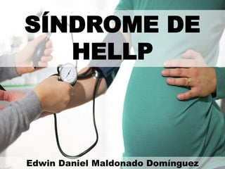 SÍNDROME DE
HELLP
Edwin Daniel Maldonado Domínguez
 