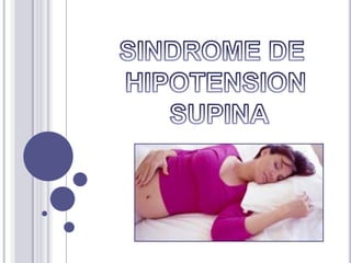 SINDROME DE  HIPOTENSION  SUPINA 