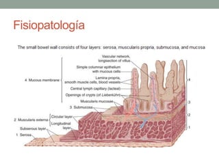 Fisiopatología
 