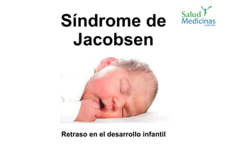 Síndrome de
Jacobsen
Retraso en el desarrollo infantil
 