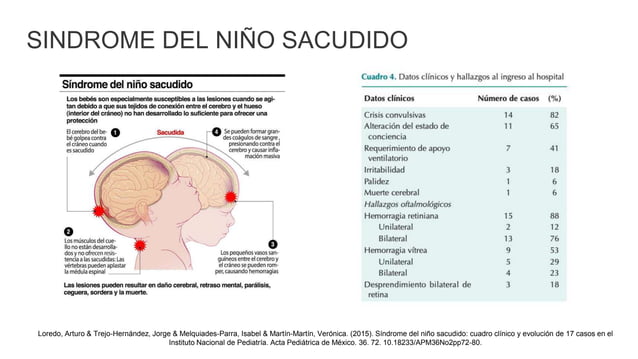 SINDROME DE KEMPE ANGUIANO.pptx