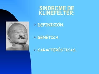 SINDROME DE KLINEFELTER: DEFINICIÓN. GENÉTICA. CARACTERÍSTICAS. 