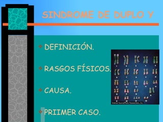 SINDROME DE DUPLO Y DEFINICIÓN. RASGOS FÍSICOS. CAUSA. PRIIMER CASO. 