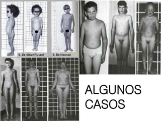 ALGUNOS
CASOS
 