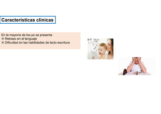 En la mayoría de los px se presenta
✽ Retraso en el lenguaje
✽ Dificultad en las habilidades de lecto escritura
Características clínicas
 