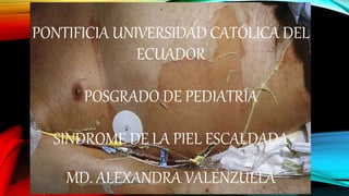 PONTIFICIA UNIVERSIDAD CATÓLICA DEL
ECUADOR
POSGRADO DE PEDIATRÍA
SINDROME DE LA PIEL ESCALDADA
MD. ALEXANDRA VALENZUELA
 