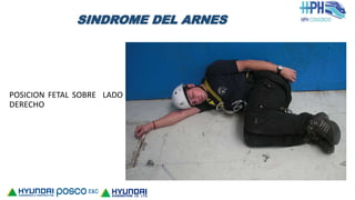 SINDROME DEL ARNES
POSICION FETAL SOBRE LADO
DERECHO
 