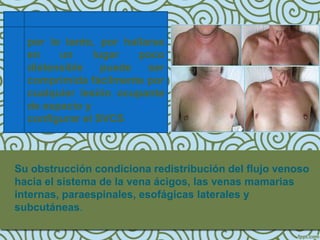 por lo tanto, por hallarse
  en    un     lugar   poco
  distensible    puede   ser
  comprimida fácilmente por
  cualquier lesión ocupante
  de espacio y
  configurar el SVCS



Su obstrucción condiciona redistribución del flujo venoso
hacia el sistema de la vena ácigos, las venas mamarias
internas, paraespinales, esofágicas laterales y
subcutáneas.
 