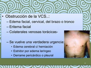 • Obstrucción de la VCS..:
  – Edema facial, cervical, del brazo o tronco
  – Eritema facial
  – Colaterales venosas torácicas-

  – Se vuelve una verdadera urgencia:
    • Edema cerebral c/ herniación
    • Estridor por edema laríngeo
    • Derrame pericárdico o pleural

                                                 7
 