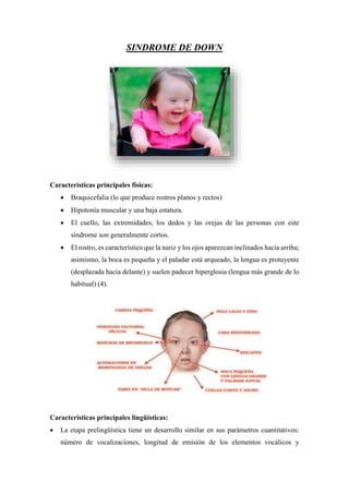 SINDROME DE DOWN
Características principales físicas:
 Braquicefalia (lo que produce rostros planos y rectos)
 Hipotonía...