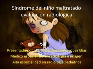 Síndrome del niño maltratado 
evaluación radiológica 
Presentado por : Dr. Francisco Javier López Elias 
Medico especialista en radiología e imagen. 
Alta especialidad en radiología pediátrica 
 
