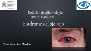 UNAN - MANAGUA
Rotación de oftalmológia
Sindrome del ojo rojo
Presentado : Jhon Mendoza
 