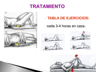 TABLA DE EJERCICIOS:   cada 3-4 horas en casa . TRATAMIENTO Liberación por presión del músculo piramidal. La pelota se sitúa lo suficientemente lateral para evitar  al nervio ciático.  