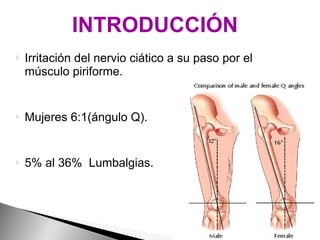 Irritación del nervio ciático a su paso por el músculo piriforme. Mujeres 6:1(ángulo Q). 5% al 36%  Lumbalgias. INTRODUCCIÓN 