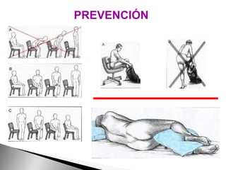 PREVENCIÓN 