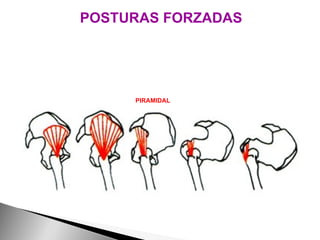 POSTURAS FORZADAS ACCIÓN ESTABILIZADORA DE LOS MÚSCULOS DURANTE LA FLEXIÓN DE LA PELVIS GLÚTEO MENOR GLÚTEO MEDIO PIRAMIDAL OBTURADOR INTERNO CUADRADO FEMORAL 