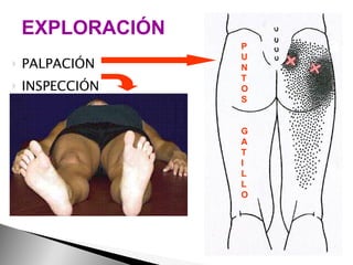 PALPACIÓN INSPECCIÓN EXPLORACIÓN P U N T O S G A T I L L O 