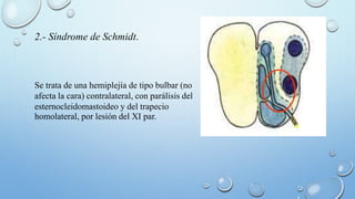 2.- Síndrome de Schmidt. 
Se trata de una hemiplejía de tipo bulbar (no 
afecta la cara) contralateral, con parálisis del 
esternocleidomastoideo y del trapecio 
homolateral, por lesión del XI par. 
 