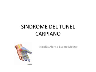 SINDROME DEL TUNEL
CARPIANO
Nicolás Alonso Espino Melgar
 