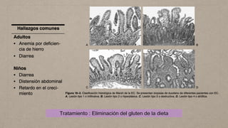 CUADRO CLÍNICO
• Diarrea osmótica crónica (>3 evacuaciones diarias por >4 semanas)
Pastosas
Fétidas
Esteatorrea (grasa en ...