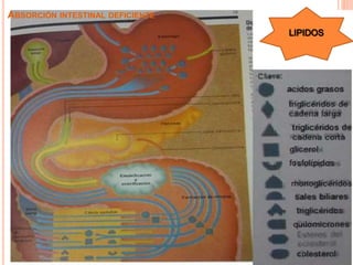 ABSORCIÓN INTESTINAL DEFICIENTE
 
