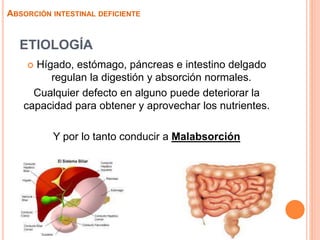 ETIOLOGÍA
 Hígado, estómago, páncreas e intestino delgado
regulan la digestión y absorción normales.
Cualquier defecto en alguno puede deteriorar la
capacidad para obtener y aprovechar los nutrientes.
Y por lo tanto conducir a Malabsorción
ABSORCIÓN INTESTINAL DEFICIENTE
 
