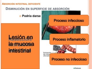DISMINUCIÓN EN SUPERFICIE DE ABSORCIÓN
 Podría darse por dos causas:
ABSORCIÓN INTESTINAL DEFICIENTE
 
