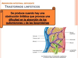 TRASTORNOS LINFÁTICOS
ABSORCIÓN INTESTINAL DEFICIENTE
 