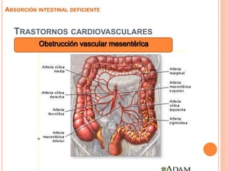 TRASTORNOS CARDIOVASCULARES
ABSORCIÓN INTESTINAL DEFICIENTE
 