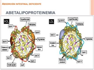 ABETALIPOPROTEINEMIA
ABSORCIÓN INTESTINAL DEFICIENTE
 
