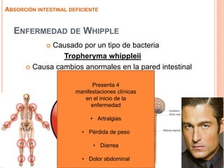 ENFERMEDAD DE WHIPPLE
 Causado por un tipo de bacteria
Tropheryma whippleii
 Causa cambios anormales en la pared intestinal
ABSORCIÓN INTESTINAL DEFICIENTE
Presenta 4
manifestaciones clínicas
en el inicio de la
enfermedad
• Artralgias
• Pérdida de peso
• Diarrea
• Dolor abdominal
 