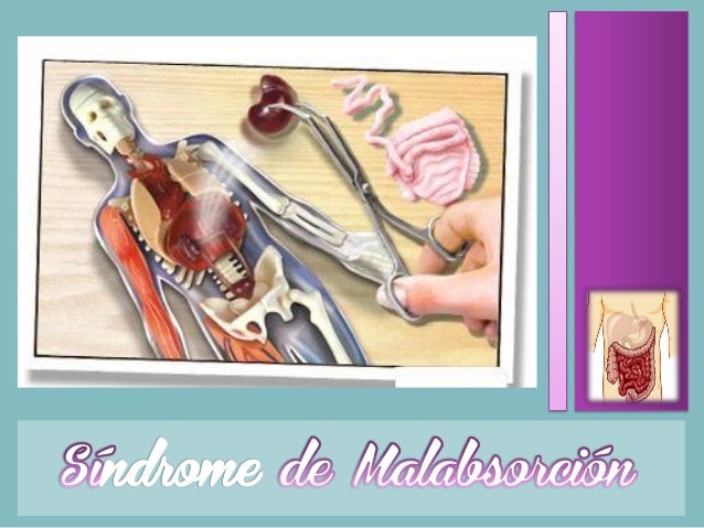 Sindrome de malabsorcion