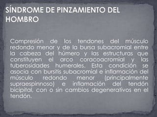 SÍNDROME DE PINZAMIENTO DEL HOMBROCompresión de los tendones del músculo redondo menor y de la bursa subacromial entre la cabeza del húmero y las estructuras que constituyen el arco coracoacromial y las tuberosidades humerales. Esta condición se asocia con bursitis subacromial e inflamación del músculo redondo menor (principalmente supraespinnoso) e inflamación del tendón bicipital, con o sin cambios degenerativos en el tendón.