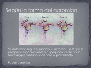 Se determina según el espacio su acromial. En el tipo III el espacio subacromial es más pequeño, existe por lo tanto mayor predisposición para el pinzamientoFactor genéticoSegún la forma del acromion