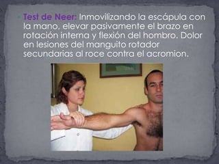 Test de Neer: Inmovilizando la escápula con la mano, elevar pasivamente el brazo en rotación interna y flexión del hombro. Dolor en lesiones del manguito rotador secundarias al roce contra el acromion.  