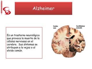 Alzheimer
Es un trastorno neurológico
que provoca la muerte de la
células nerviosas en el
cerebro. Sus síntomas se
atribuyen a la vejez o al
olvido común.
 