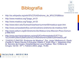 Sindrome de Moebius | PPT