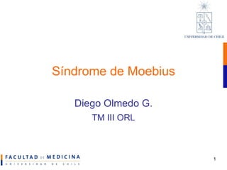 Síndrome de Moebius Diego Olmedo G. TM III ORL 