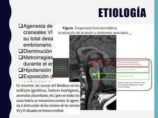 ETIOLOGÍA
Agenesia de los pares
craneales VI y VII impidiendo
su total desarrollo
embrionario.
Disminución del flujo uterino
Metrorragias intensas
durante el embarazo
Hipotensión severa
Exposición durante el
embarazo a vasoconstrictores
 