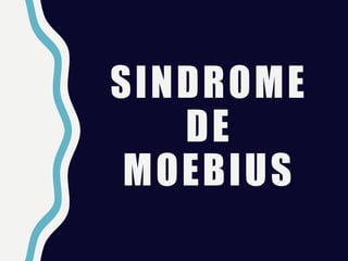 SINDROME
DE
MOEBIUS
 