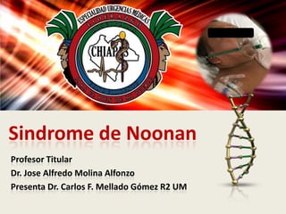 Sindrome de Noonan
Profesor Titular
Dr. Jose Alfredo Molina Alfonzo
Presenta Dr. Carlos F. Mellado Gómez R2 UM
 