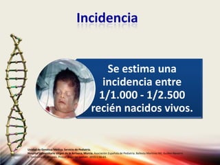 Incidencia
Se estima una
incidencia entre
1/1.000 - 1/2.500
recién nacidos vivos.
Unidad de Genética Médica. Servicio de Pediatría.
Hospital Universitario Virgen de la Arrixaca, Murcia. Asociación Española de Pediatría. Ballesta Martinez MJ, Guillen-Navarro
E. Sindrome de Noonan. Protoc diagn ter pediatr. 2010;1:56-63.
 