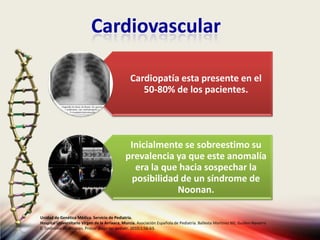 Cardiovascular
Unidad de Genética Médica. Servicio de Pediatría.
Hospital Universitario Virgen de la Arrixaca, Murcia. Asociación Española de Pediatría. Ballesta Martinez MJ, Guillen-Navarro
E. Sindrome de Noonan. Protoc diagn ter pediatr. 2010;1:56-63.
Cardiopatía esta presente en el
50-80% de los pacientes.
Inicialmente se sobreestimo su
prevalencia ya que este anomalía
era la que hacia sospechar la
posibilidad de un síndrome de
Noonan.
 
