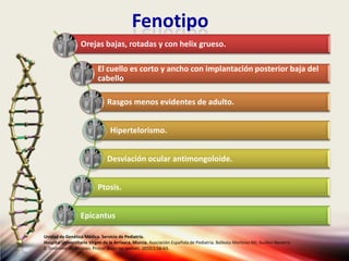 Fenotipo
Unidad de Genética Médica. Servicio de Pediatría.
Hospital Universitario Virgen de la Arrixaca, Murcia. Asociación Española de Pediatría. Ballesta Martinez MJ, Guillen-Navarro
E. Sindrome de Noonan. Protoc diagn ter pediatr. 2010;1:56-63.
Orejas bajas, rotadas y con helix grueso.
El cuello es corto y ancho con implantación posterior baja del
cabello
Rasgos menos evidentes de adulto.
Hipertelorismo.
Desviación ocular antimongoloide.
Ptosis.
Epicantus
 