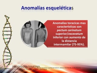 Anomalías esqueléticas
Anomalias toracicas mas
caracteristicas son
pectum carinatum
superior/excavatum
inferior con aumento de
la distancia
intermamilar (75-95%).
Unidad de Genética Médica. Servicio de Pediatría.
Hospital Universitario Virgen de la Arrixaca, Murcia. Asociación Española de Pediatría. Ballesta Martinez MJ, Guillen-Navarro
E. Sindrome de Noonan. Protoc diagn ter pediatr. 2010;1:56-63.
 