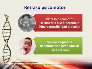 Retraso psicomotor
Unidad de Genética Médica. Servicio de Pediatría.
Hospital Universitario Virgen de la Arrixaca, Murcia. Asociación Española de Pediatría. Ballesta Martinez MJ, Guillen-Navarro
E. Sindrome de Noonan. Protoc diagn ter pediatr. 2010;1:56-63.
Retraso psicomotor
secundario a la hipotonía e
hiperextensibilidad articular.
Suelen adquirir la
deambulación alrededor de
los 21 meses
 