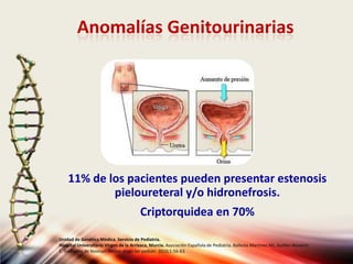 Anomalías Genitourinarias
11% de los pacientes pueden presentar estenosis
pieloureteral y/o hidronefrosis.
Criptorquidea en 70%
Unidad de Genética Médica. Servicio de Pediatría.
Hospital Universitario Virgen de la Arrixaca, Murcia. Asociación Española de Pediatría. Ballesta Martinez MJ, Guillen-Navarro
E. Sindrome de Noonan. Protoc diagn ter pediatr. 2010;1:56-63.
 