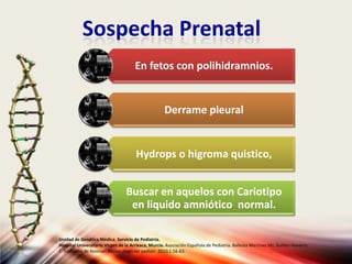 Sospecha Prenatal
En fetos con polihidramnios.
Derrame pleural
Hydrops o higroma quistico,
Buscar en aquelos con Cariotipo
en liquido amniótico normal.
Unidad de Genética Médica. Servicio de Pediatría.
Hospital Universitario Virgen de la Arrixaca, Murcia. Asociación Española de Pediatría. Ballesta Martinez MJ, Guillen-Navarro
E. Sindrome de Noonan. Protoc diagn ter pediatr. 2010;1:56-63.
 