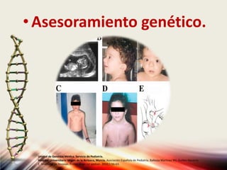 •Asesoramiento genético.
Unidad de Genética Médica. Servicio de Pediatría.
Hospital Universitario Virgen de la Arrixaca, Murcia. Asociación Española de Pediatría. Ballesta Martinez MJ, Guillen-Navarro
E. Sindrome de Noonan. Protoc diagn ter pediatr. 2010;1:56-63.
 