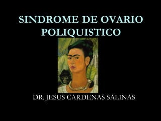 SINDROME DE OVARIO
POLIQUISTICO

DR. JESUS CARDENAS SALINAS

 